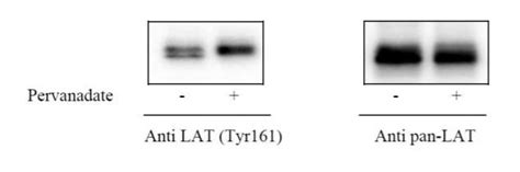 LAT1 ELISA Kits 